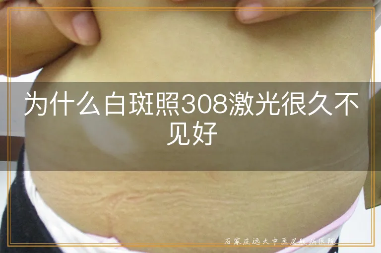 为什么白斑照308激光很久不见好