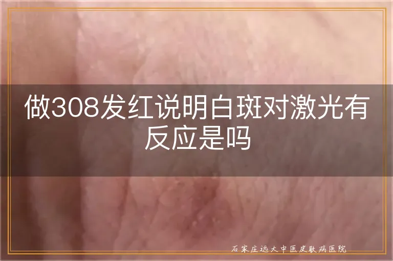 做308发红说明白斑对激光有反应是吗