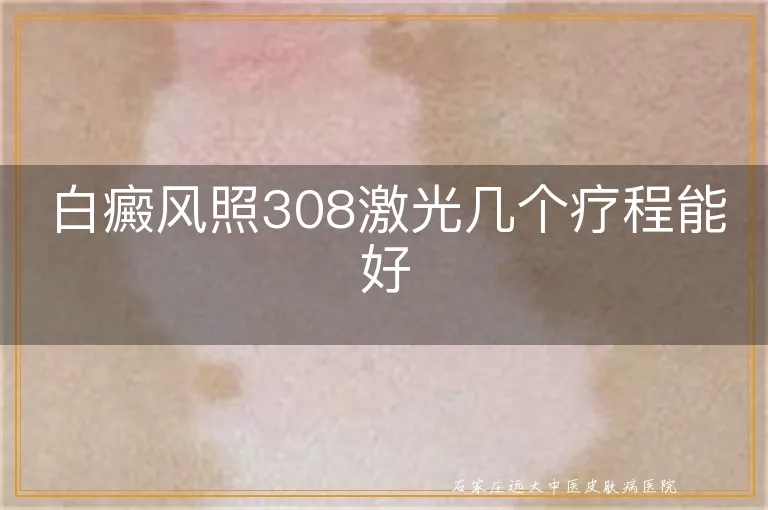 白癜风照308激光几个疗程能好