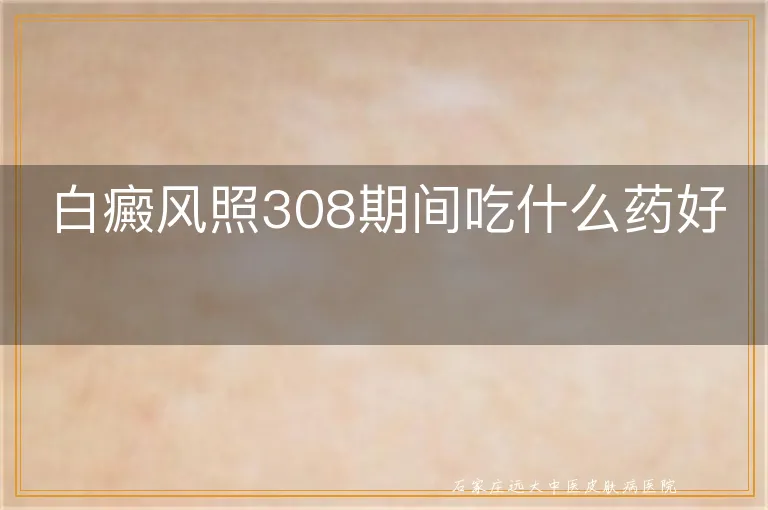 白癜风照308期间吃什么药好