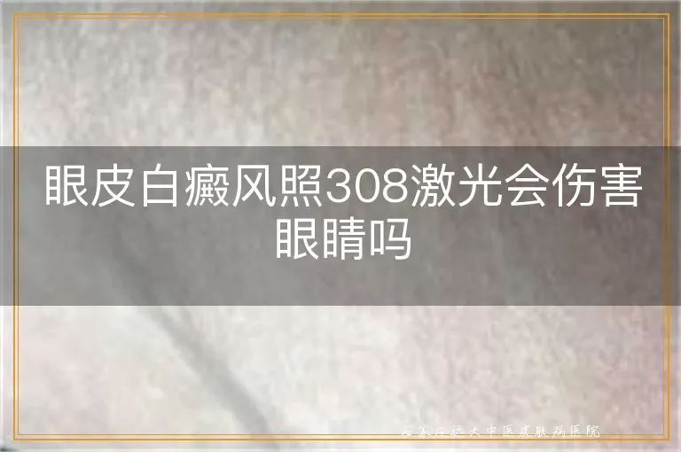 眼皮白癜风照308激光会伤害眼睛吗