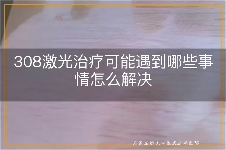 308激光治疗可能遇到哪些事情怎么解决