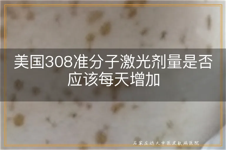 美国308准分子激光剂量是否应该每天增加