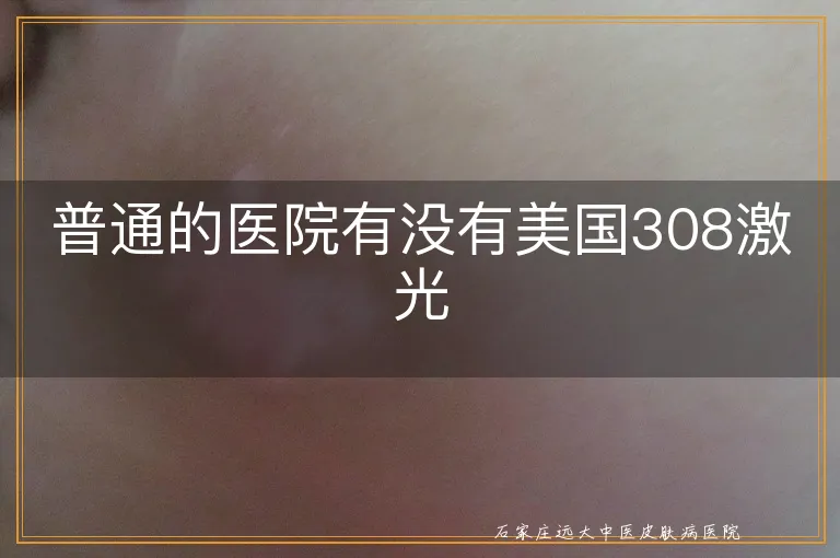 普通的医院有没有美国308激光