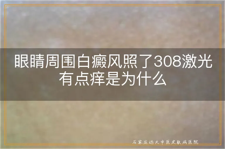 眼睛周围白癜风照了308激光有点痒是为什么