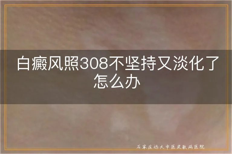 白癜风照308不坚持又淡化了怎么办