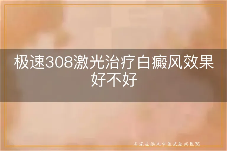 极速308激光治疗白癜风效果好不好