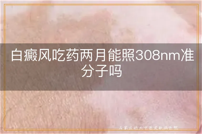 白癜风吃药两月能照308nm准分子吗