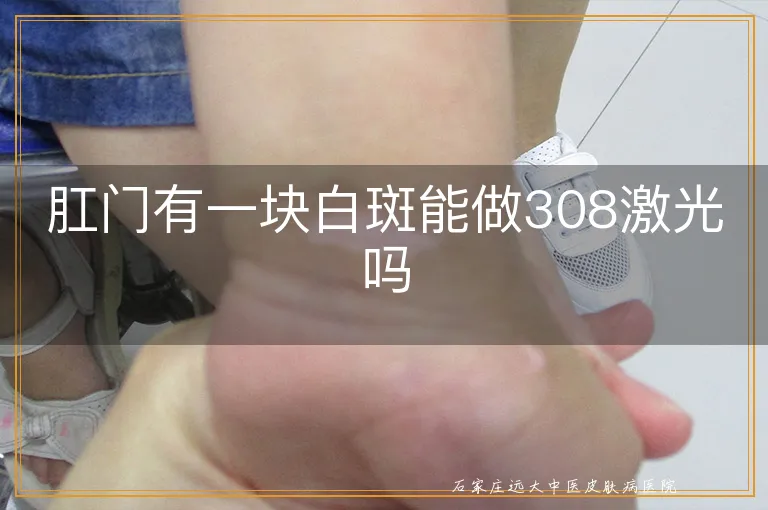 肛门有一块白斑能做308激光吗