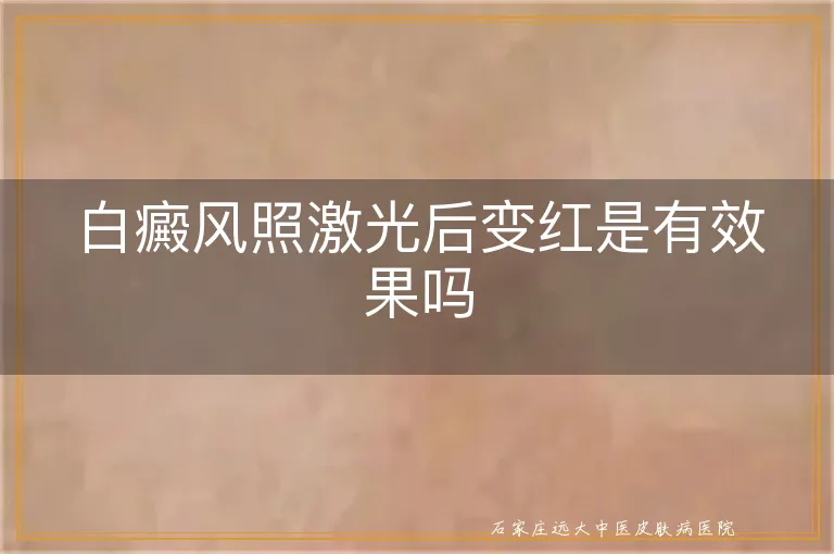 白癜风照激光后变红是有效果吗