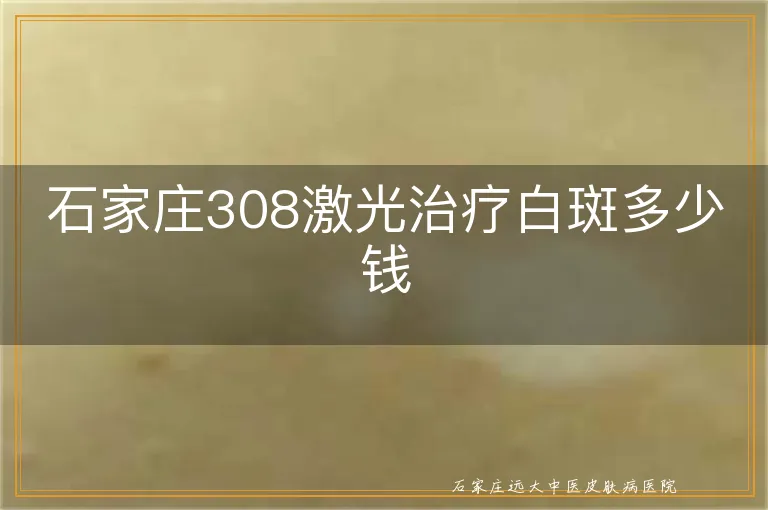 石家庄308激光治疗白斑多少钱