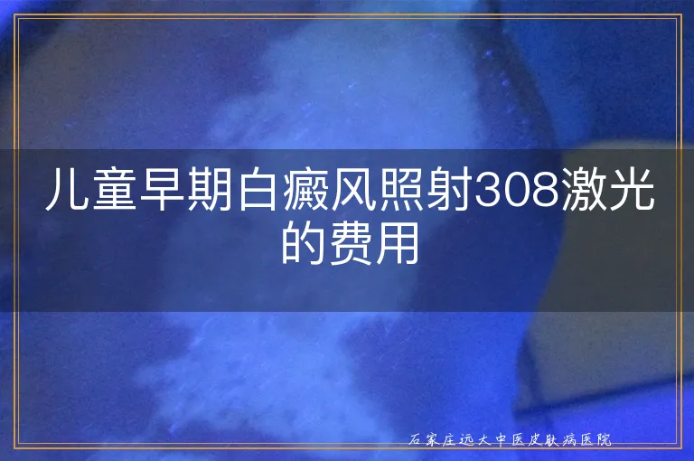 儿童早期白癜风照射308激光的费用