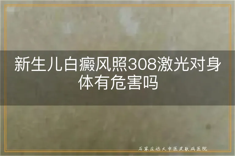 新生儿白癜风照308激光对身体有危害吗