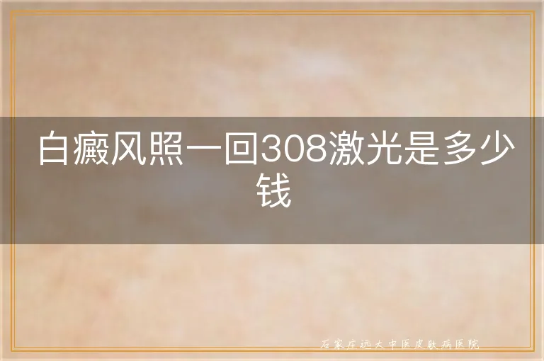 白癜风照一回308激光是多少钱