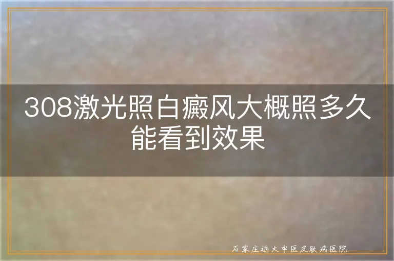 308激光照白癜风大概照多久能看到效果