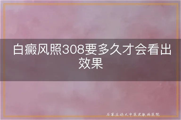 白癜风照308要多久才会看出效果