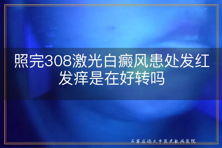 照完308激光白癜风患处发红发痒是在好转吗