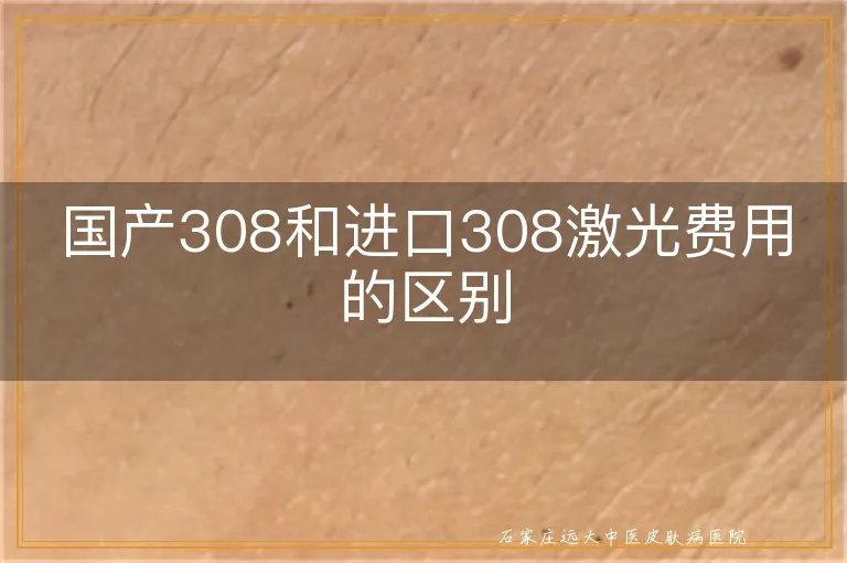 国产308和进口308激光费用的区别