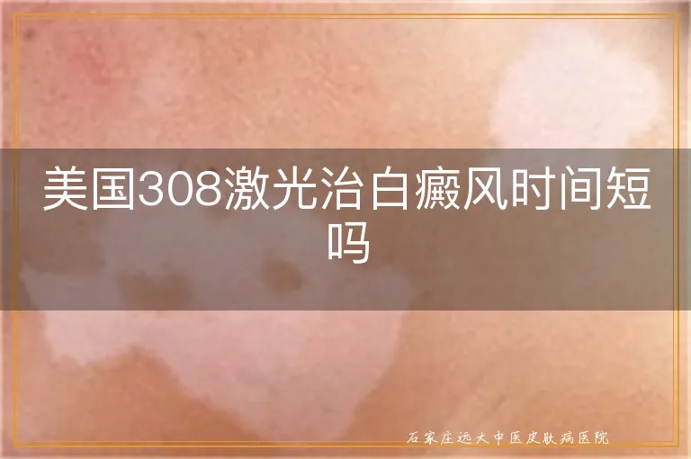 美国308激光治白癜风时间短吗