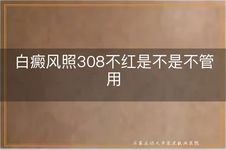 白癜风照308不红是不是不管用