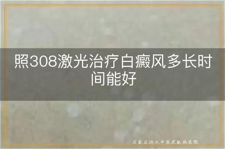 照308激光治疗白癜风多长时间能好