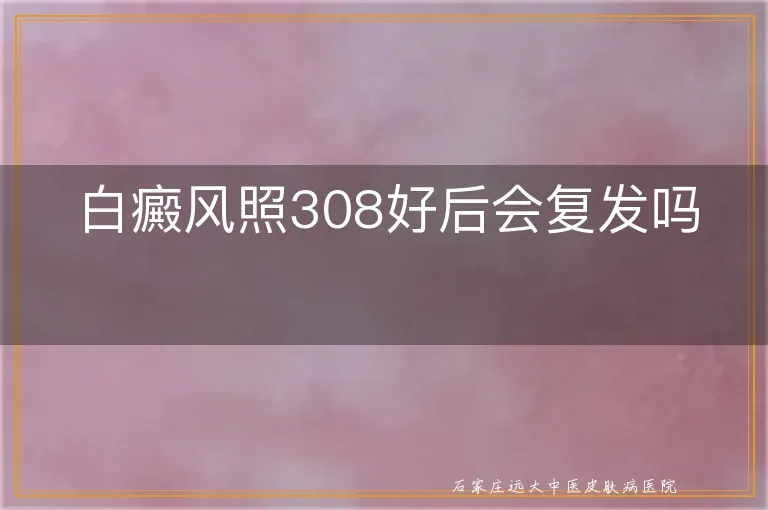 白癜风照308好后会复发吗