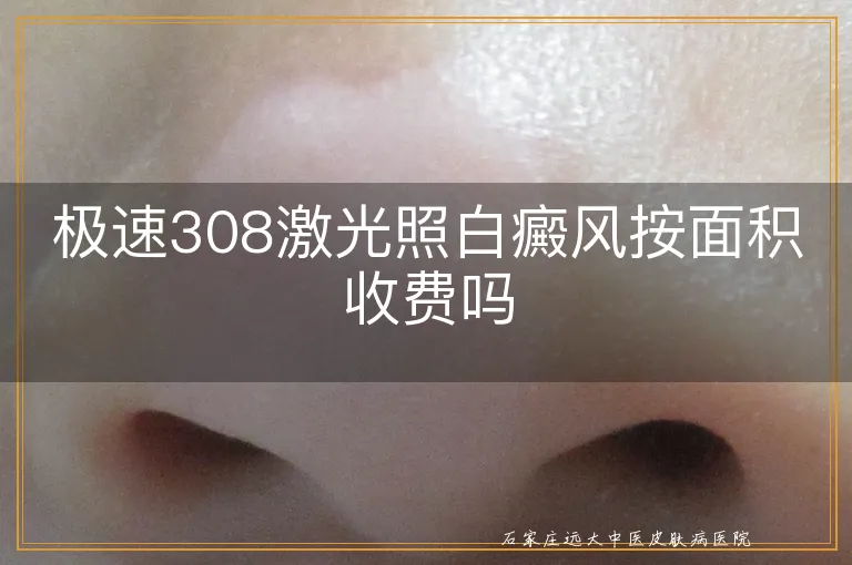 极速308激光照白癜风按面积收费吗