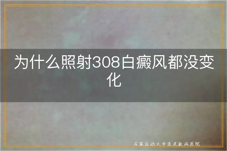 为什么照射308白癜风都没变化