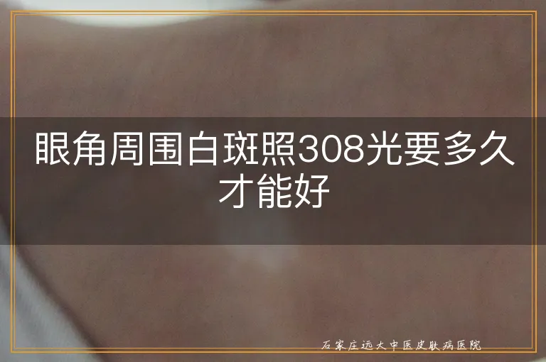 眼角周围白斑照308光要多久才能好