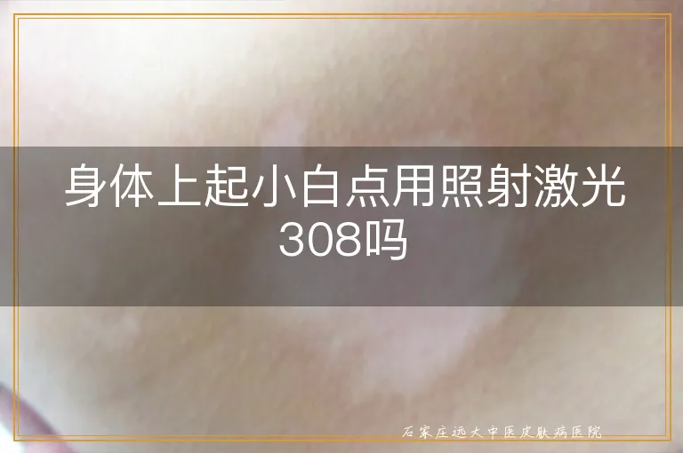 身体上起小白点用照射激光308吗