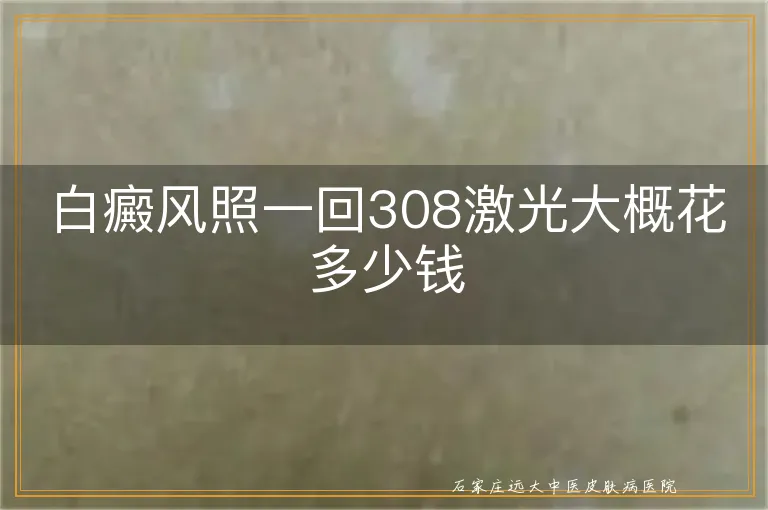 白癜风照一回308激光大概花多少钱