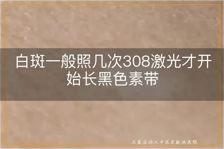 白斑一般照几次308激光才开始长黑色素带