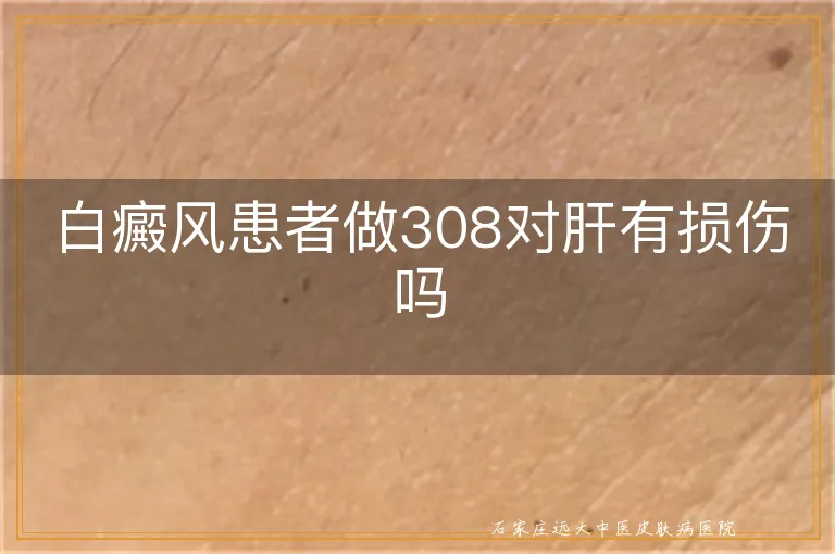 白癜风患者做308对肝有损伤吗