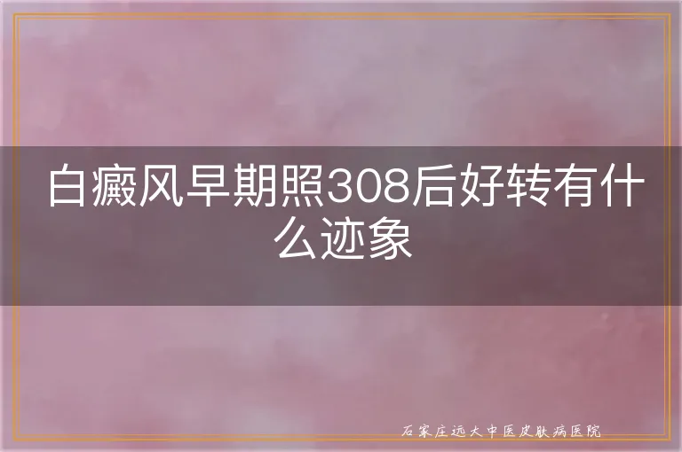 白癜风早期照308后好转有什么迹象