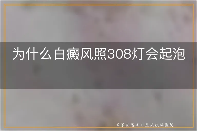 为什么白癜风照308灯会起泡