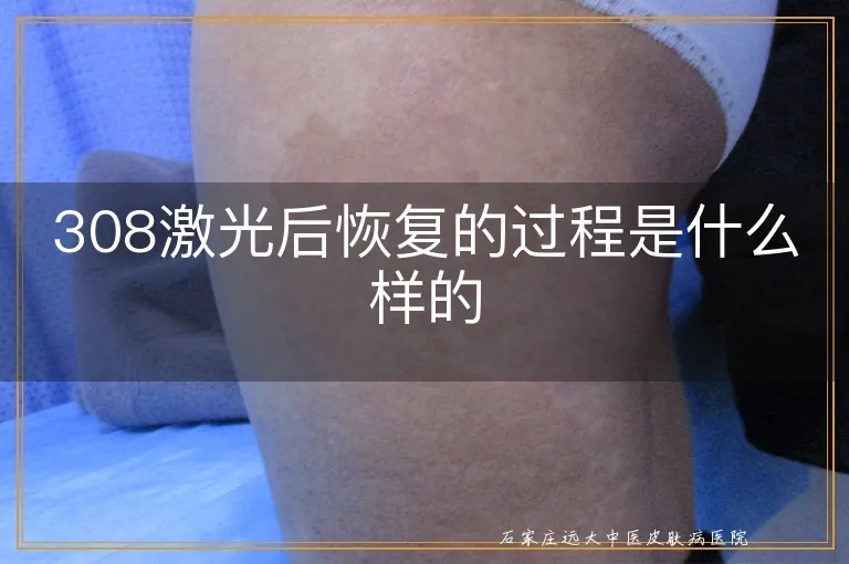 308激光后恢复的过程是什么样的