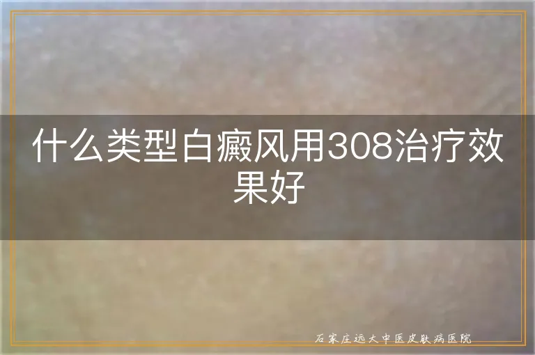 什么类型白癜风用308治疗效果好