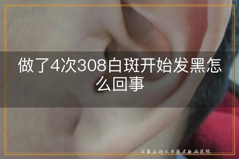 做了4次308白斑开始发黑怎么回事