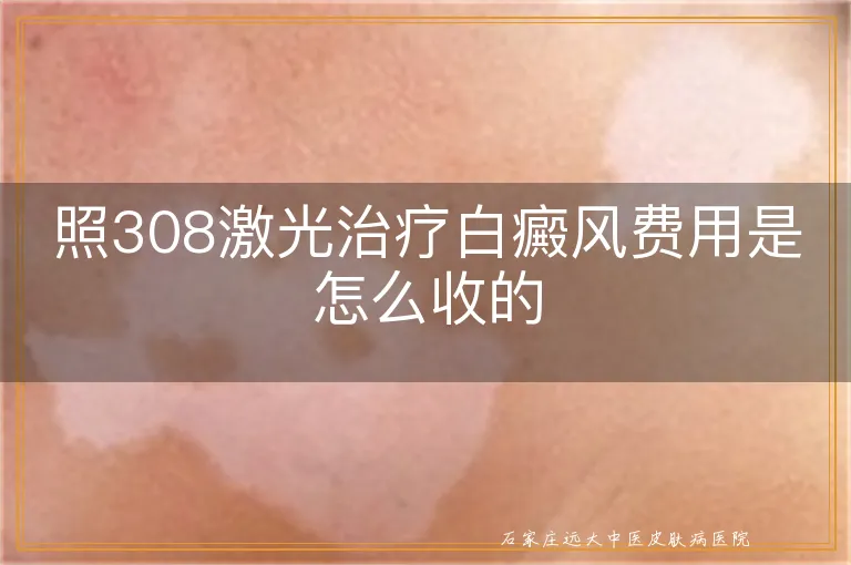 照308激光治疗白癜风费用是怎么收的