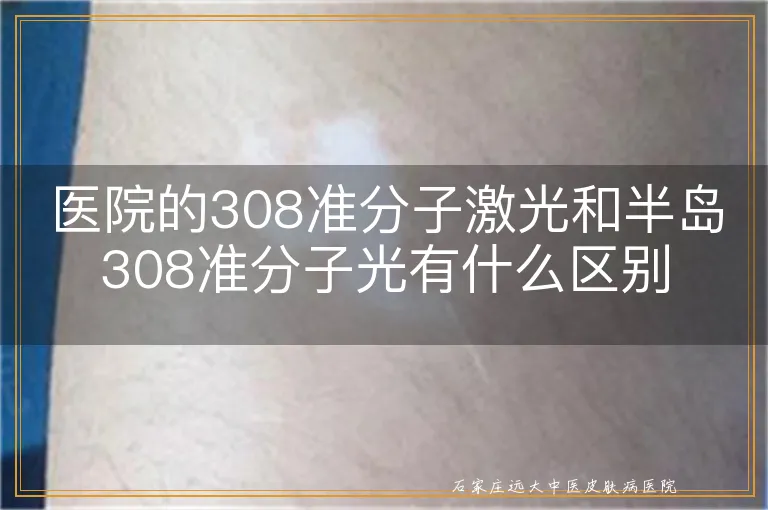 医院的308准分子激光和半岛308准分子光有什么区别