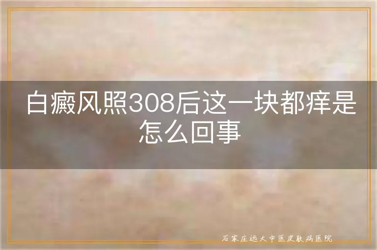 白癜风照308后这一块都痒是怎么回事