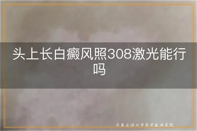 头上长白癜风照308激光能行吗