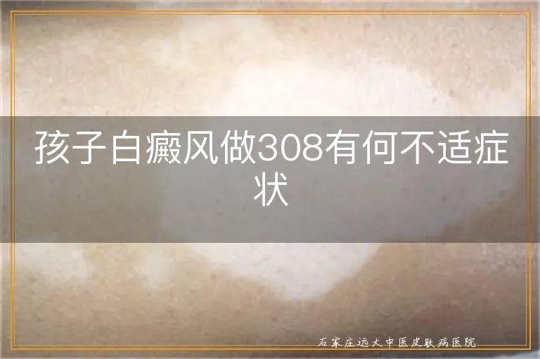 孩子白癜风做308有何不适症状