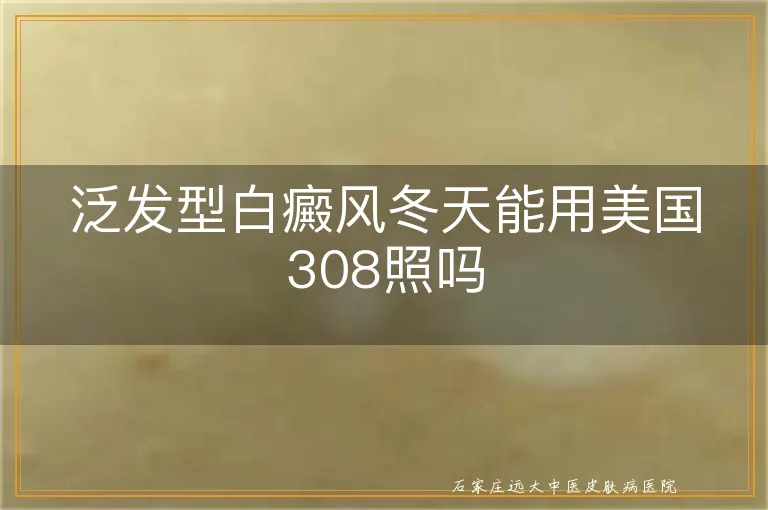 泛发型白癜风冬天能用美国308照吗