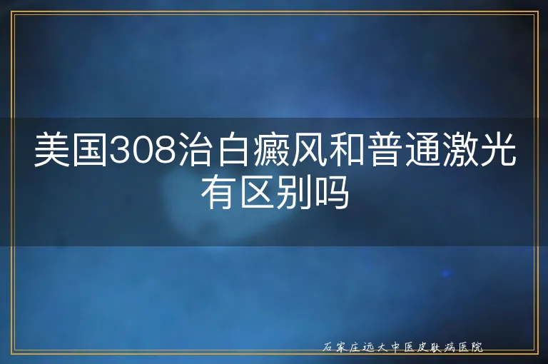 美国308治白癜风和普通激光有区别吗