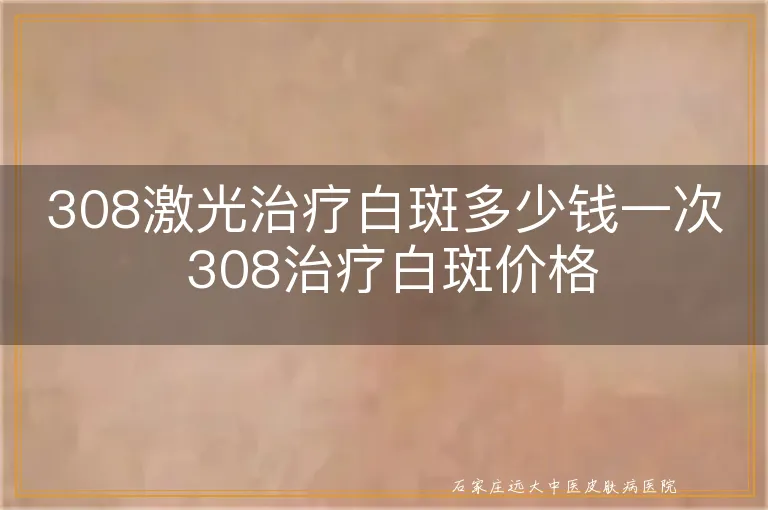 308激光治疗白斑多少钱一次 308治疗白斑价格