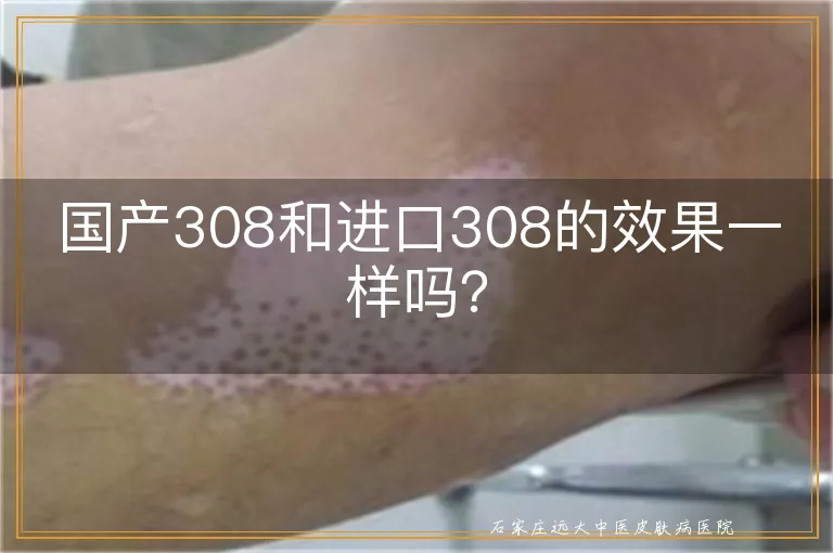 国产308和进口308的效果一样吗？