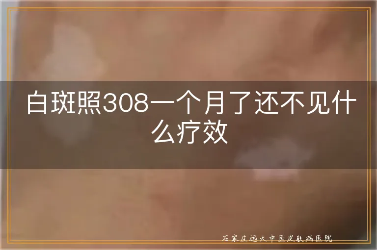 白斑照308一个月了还不见什么疗效