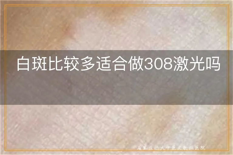 白斑比较多适合做308激光吗