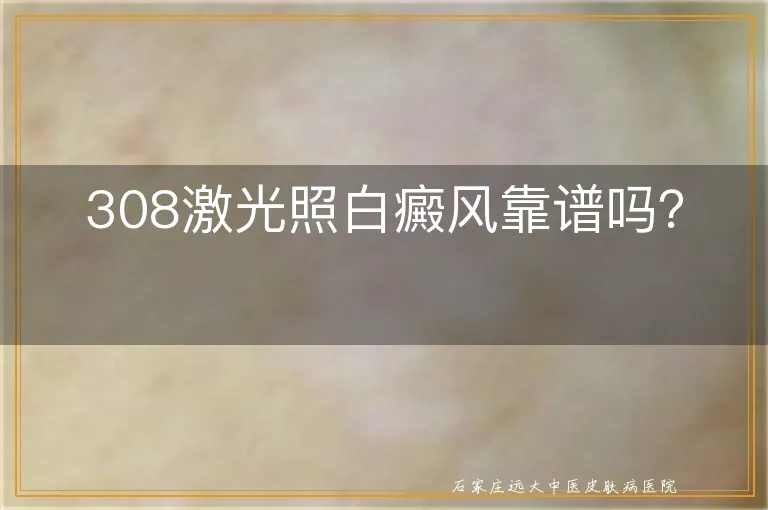 308激光照白癜风靠谱吗？